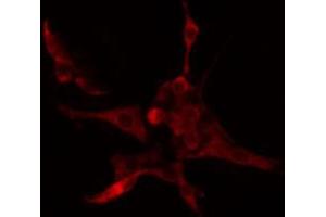 ABIN6274659 staining COLO205 cells by IF/ICC. (CYP4B1 Antikörper  (Internal Region))