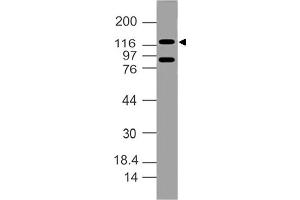 Image no. 1 for anti-Damage Specific DNA Binding Protein 1 (DDB1) (AA 300-530) antibody (ABIN5027134) (DDB1 Antikörper  (AA 300-530))