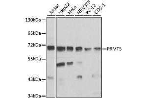 Western blot analysis of extracts of various cell lines, using PRMT5 antibody (ABIN1874327) at 1:1000 dilution. (PRMT5 Antikörper)