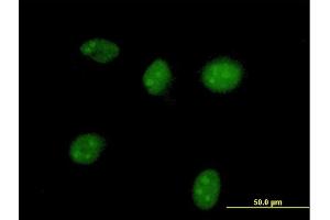 Immunofluorescence of purified MaxPab antibody to HGD on HeLa cell. (HGD Antikörper  (AA 1-445))