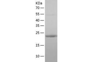 RAB3A Protein (AA 1-220) (His tag)