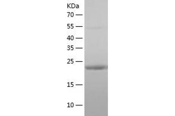 RAB3A Protein (AA 1-220) (His tag)