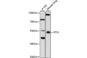 Western blot analysis of extracts of various cell lines, using SPRY3 antibody (ABIN6133259, ABIN6140325, ABIN6140326 and ABIN6223170) at 1:1000 dilution. (ETS2 Antikörper  (AA 160-350))