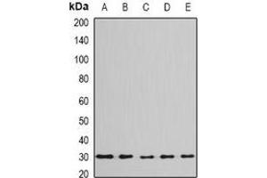 Western blot analysis of BPGM expression in Jurkat (A), Hela (B), mouse liver (C), mouse testis (D), rat brain (E) whole cell lysates. (BPGM Antikörper)
