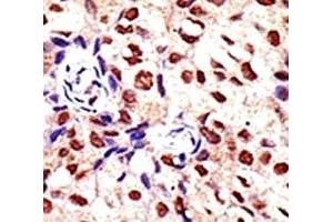 Immunohistochemistry (IHC) image for anti-Protein Arginine Methyltransferase 2 (PRMT2) (AA 22-53) antibody (ABIN3032356)