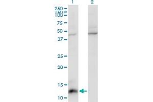 Western Blot analysis of CCL7 expression in transfected 293T cell line by CCL7 monoclonal antibody (M03), clone 4B5. (CCL7 Antikörper  (AA 24-99))