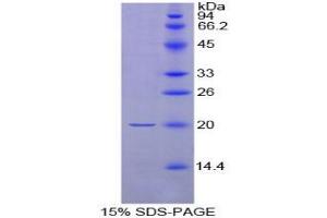 SDS-PAGE analysis of Rat Neurotensin Protein.