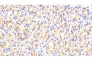 Detection of vWA1 in Rat Stomach Tissue using Polyclonal Antibody to Von Willebrand Factor A Domain Containing Protein 1 (vWA1) (VWA1 Antikörper  (AA 43-285))