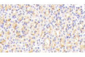 Detection of vWA1 in Rat Stomach Tissue using Polyclonal Antibody to Von Willebrand Factor A Domain Containing Protein 1 (vWA1) (VWA1 Antikörper  (AA 43-285))