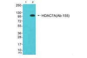 Western blot analysis of extracts from JK cells (Lane 2), using HDAC7A (Ab-155) antiobdy. (HDAC7 Antikörper  (Ser155))