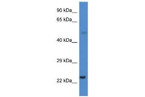 WB Suggested Anti-CYP1B1 Antibody Titration: 0. (CYP1B1 Antikörper  (Middle Region))