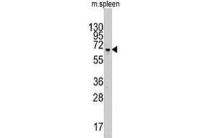 Western blot analysis of Parp3 polyclonal antibody  in mouse spleen tissue lysate (35 ug/lane). (PARP3 Antikörper  (C-Term))