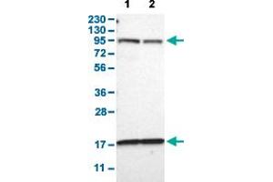 Western Blot analysis with DPP8 polyclonal antibody . (DPP8 Antikörper  (AA 17-135))