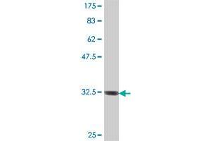 Western Blot detection against Immunogen (33. (SEC22C Antikörper  (AA 3-68))