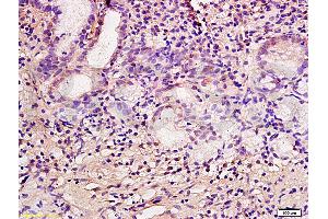 Formalin-fixed and paraffin embedded human gastric mucosa labeled with Anti-CA IX/CA9 Polyclonal Antibody, Unconjugated (ABIN752773) at 1:200 followed by conjugation to the secondary antibody and DAB staining. (CA9 Antikörper  (AA 251-350))