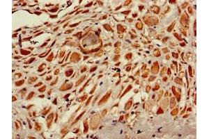 Immunohistochemistry of paraffin-embedded human placenta tissue using ABIN7168188 at dilution of 1:100 (MSK1 Antikörper  (AA 224-367))