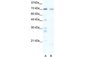 WB Suggested Anti-SOX13 Antibody Titration:  5. (SOX13 Antikörper  (C-Term))