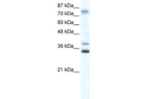 Western Blotting (WB) image for anti-Zinc Finger Protein 570 (ZNF570) antibody (ABIN2461299) (ZNF570 Antikörper)