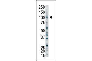 Image no. 1 for anti-Ubiquitin Protein Ligase E3A (ube3a) (C-Term) antibody (ABIN357571) (ube3a Antikörper  (C-Term))