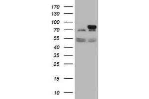 Image no. 3 for anti-Galactosidase, beta 1 (GLB1) antibody (ABIN1498466)