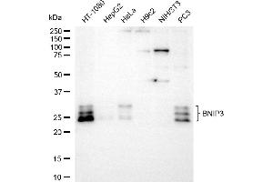 Western blotting analysis using BNIP3 antibody (ABIN7797759).