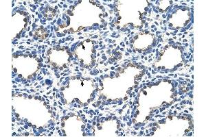 EMP2 antibody was used for immunohistochemistry at a concentration of 4-8 ug/ml to stain Alveolar cells (arrows) in Human Lung. (EMP2 Antikörper  (Middle Region))