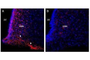 Expression of FFAR4 in rat hypothalamus. (O3FAR1 Antikörper  (Extracellular, N-Term))
