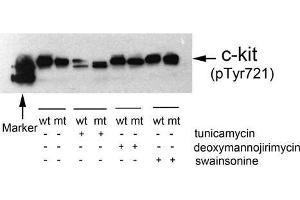 Western blot analysis of extracts from 293T cells(transfected with wild or mutant type c-kit/pc DNA3. (KIT Antikörper  (pTyr721))