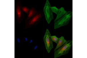 ABIN6260564 and ABIN6278557 staining  cells by IF/ICC. (CCRL2 Antikörper  (Internal Region))