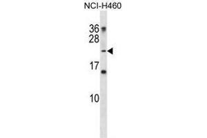 TNNI2 Antibody (N-term) western blot analysis in NCI-H460 cell line lysates (35 µg/lane). (TNNI2 Antikörper  (N-Term))