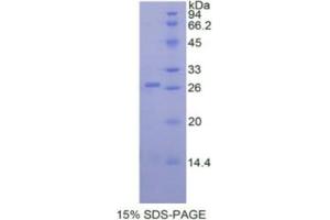 SDS-PAGE analysis of Human ADAM17 Protein.