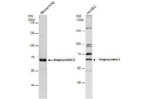 WB Image Angiopoietin 2 antibody detects Angiopoietin 2 protein by western blot analysis. (Angiopoietin 2 Antikörper)