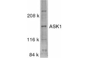 Image no. 1 for anti-Mitogen-Activated Protein Kinase Kinase Kinase 5 (MAP3K5) (C-Term) antibody (ABIN318975) (ASK1 Antikörper  (C-Term))