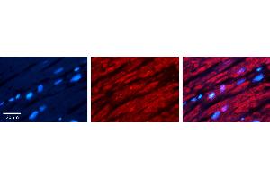 Rabbit Anti-CRY2 Antibody Catalog Number: ARP52398_P050 Formalin Fixed Paraffin Embedded Tissue: Human heart Tissue Observed Staining: Cytoplasmic Primary Antibody Concentration: 1:100 Other Working Concentrations: N/A Secondary Antibody: Donkey anti-Rabbit-Cy3 Secondary Antibody Concentration: 1:200 Magnification: 20X Exposure Time: 0. (CRY2 Antikörper  (N-Term))