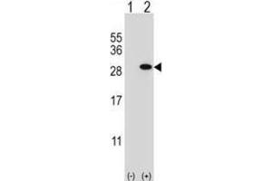 Western Blotting (WB) image for anti-Glutathione S-Transferase theta 1 (GSTT1) antibody (ABIN2997016)