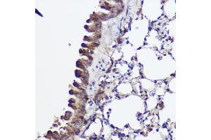 Immunohistochemistry of paraffin-embedded mouse lung using A Rabbit pAb (ABIN7265731) at dilution of 1:100 (40x lens). (ABCA8A Antikörper)