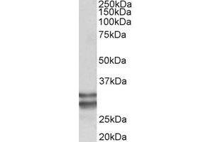 Western Blotting (WB) image for anti-Kruppel-Like Factor 13 (KLF13) (Internal Region) antibody (ABIN2465028) (KLF13 Antikörper  (Internal Region))