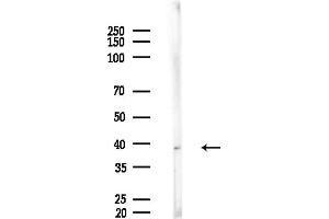 Western blot analysis of lysates from EC304 cells, using AW Antibody at 1/1000 dilution.
