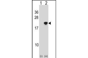 Western blot analysis of NANOS2 (arrow) using rabbit polyclonal NANOS2 Antibody (Center) (ABIN1538503 and ABIN2849951). (NANOS2 Antikörper  (AA 58-85))