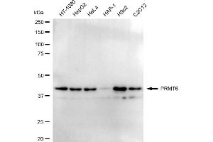 Western blotting analysis using PRMT6 antibody (ABIN7799972). (Rekombinanter PRMT6 Antikörper)