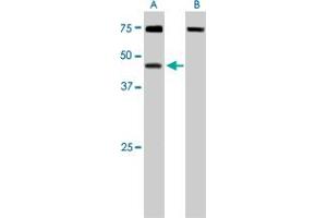DYX1C1 polyclonal antibody  staining (0. (DYX1C1 Antikörper)