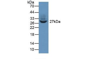 Figure. (TWF1 Antikörper  (AA 1-252))