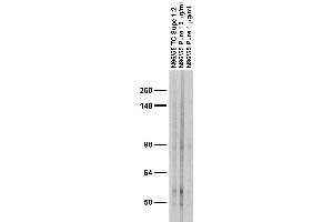 Adult rat brain membrane immunoblot.