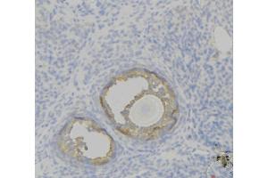 ABIN6276821 at 1/100 staining Human uterus tissue by IHC-P. (F12 Antikörper  (C-Term))