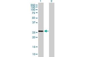 Western Blot analysis of BTG4 expression in transfected 293T cell line by BTG4 MaxPab polyclonal antibody.