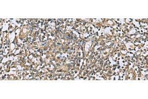Immunohistochemistry of paraffin-embedded Human tonsil tissue using LFNG Polyclonal Antibody at dilution of 1:60(x200) (LFNG Antikörper)