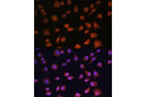 Immunofluorescence analysis of L929 cells using RPS19BP1 antibody (ABIN6132999, ABIN6147207, ABIN6147208 and ABIN6217154) at dilution of 1:100. (RPS19BP1 Antikörper  (AA 1-136))