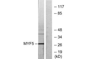 Western blot analysis of extracts from HepG2 cells, using MYF5 antibody. (MYF5 Antikörper  (Internal Region))