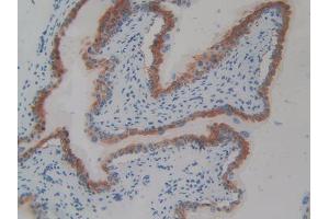 DAB staining on IHC-P; Samples: Mouse Vas Deferens Tissue (CD109 Antikörper  (AA 890-1131))