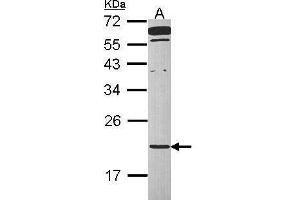 WB Image Sample (30 ug of whole cell lysate) A: Raji 12% SDS PAGE antibody diluted at 1:1000 (TMED2 Antikörper  (Center))